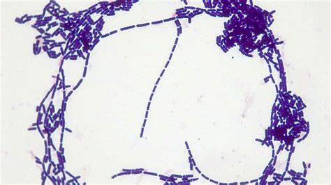 bacillus subtilis negative stain